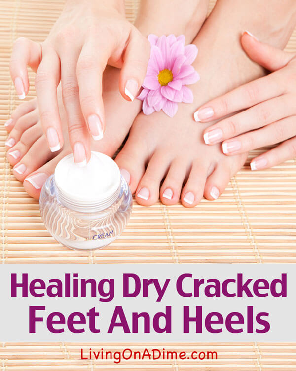 Healing Dry Cracked Feet And Heels