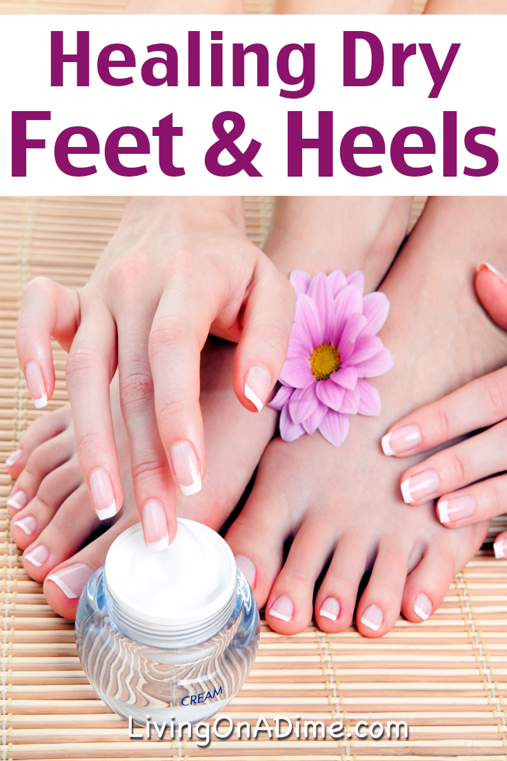 Healing Dry Feet And Cracked Heels Easy Treatment That Works Fast